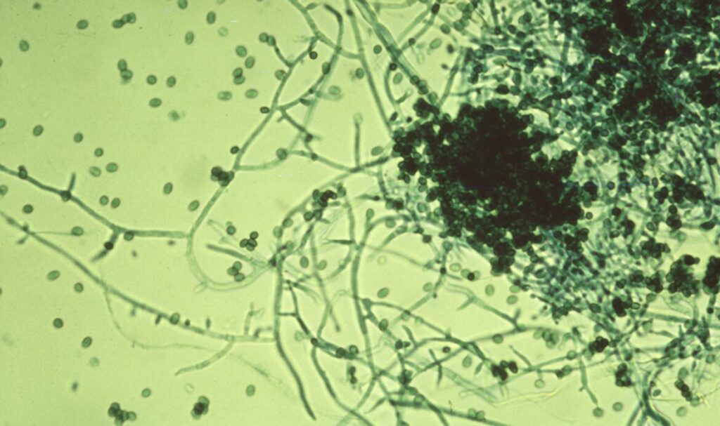 richoderma viride, conidia/conidiophores